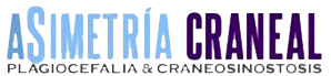 Plagiocefalia